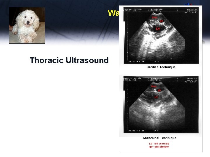 Waddles Thoracic Ultrasound 