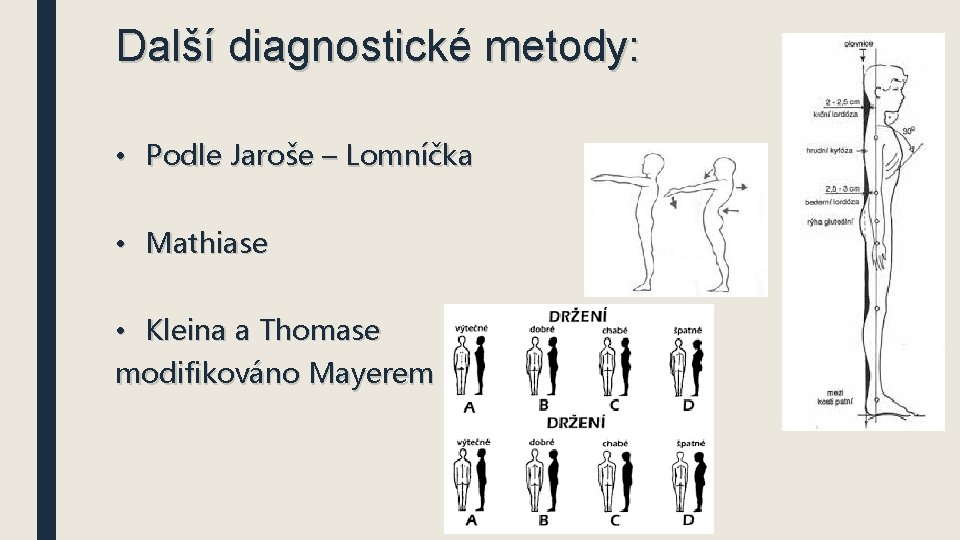 Další diagnostické metody: • Podle Jaroše – Lomníčka • Mathiase • Kleina a Thomase