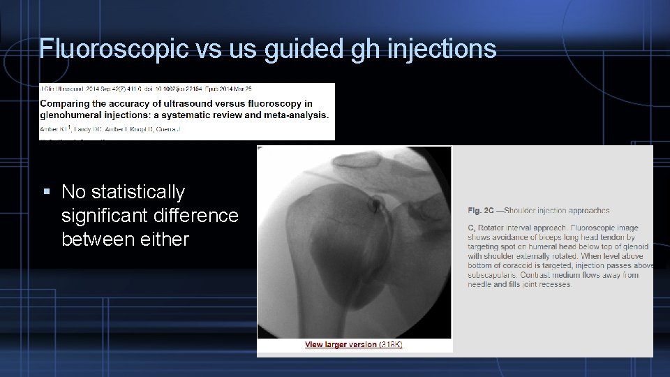 Fluoroscopic vs us guided gh injections No statistically significant difference between either 