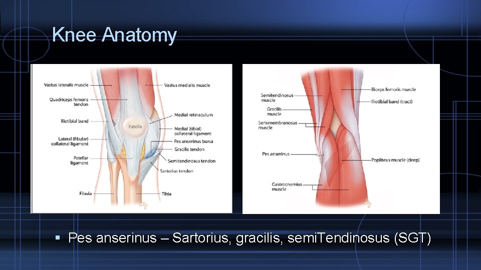 Knee Anatomy Pes anserinus – Sartorius, gracilis, semi. Tendinosus (SGT) 