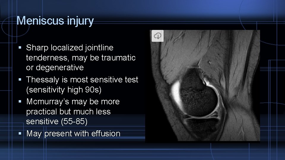 Meniscus injury Sharp localized jointline tenderness, may be traumatic or degenerative Thessaly is most