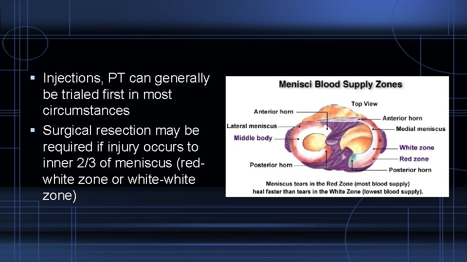  Injections, PT can generally be trialed first in most circumstances Surgical resection may