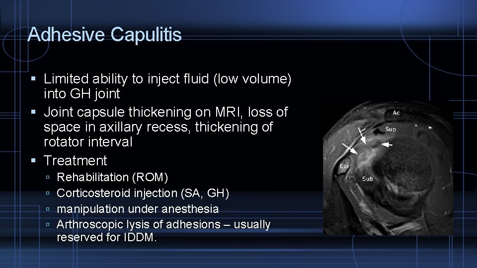 Adhesive Capulitis Limited ability to inject fluid (low volume) into GH joint Joint capsule