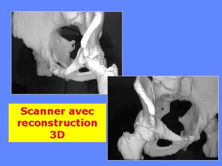 Scanner avec reconstruction 3 D 