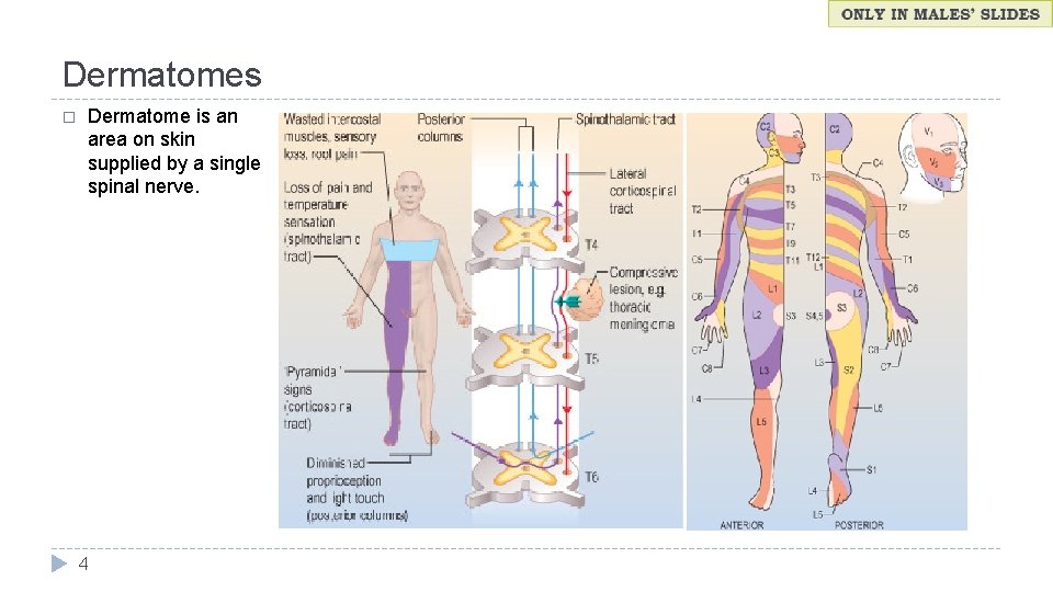 Dermatomes � Dermatome is an area on skin supplied by a single spinal nerve.