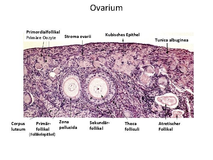 Ovarium Primordialfollikel Stroma ovarii Primäre Oozyte Corpus luteum Primärfollikel (Follikelepithel) Zona pellucida Kubisches Epithel
