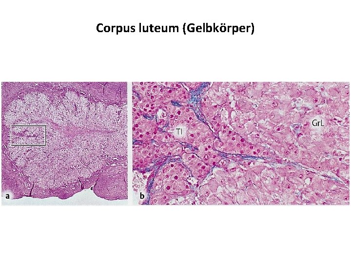 Corpus luteum (Gelbkörper) 