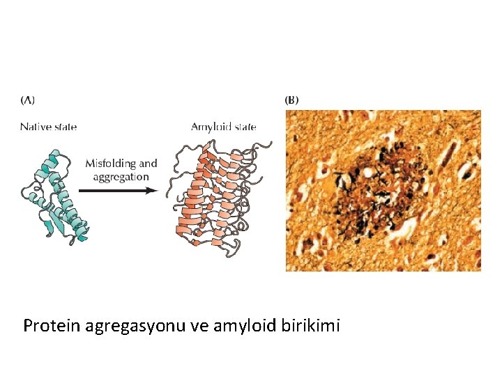 Protein agregasyonu ve amyloid birikimi 