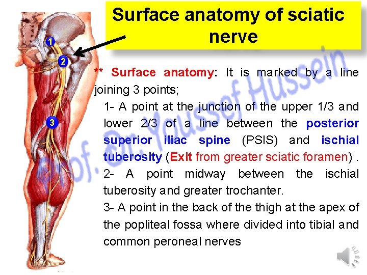 Surface anatomy of sciatic nerve 1 1 2 2 3 3 ** Surface anatomy: