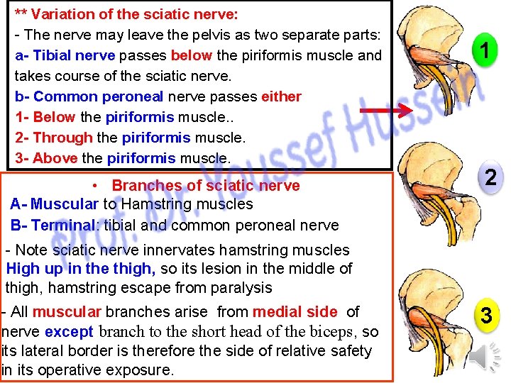 ** Variation of the sciatic nerve: - The nerve may leave the pelvis as