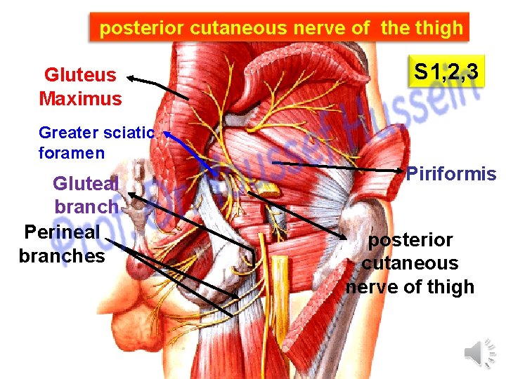 posterior cutaneous nerve of the thigh Gluteus Maximus S 1, 2, 3 Greater sciatic