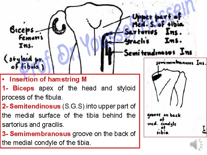  • Insertion of hamstring M 1 - Biceps apex of the head and