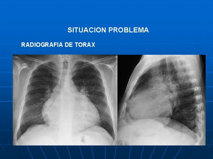 SITUACION PROBLEMA RADIOGRAFIA DE TORAX 