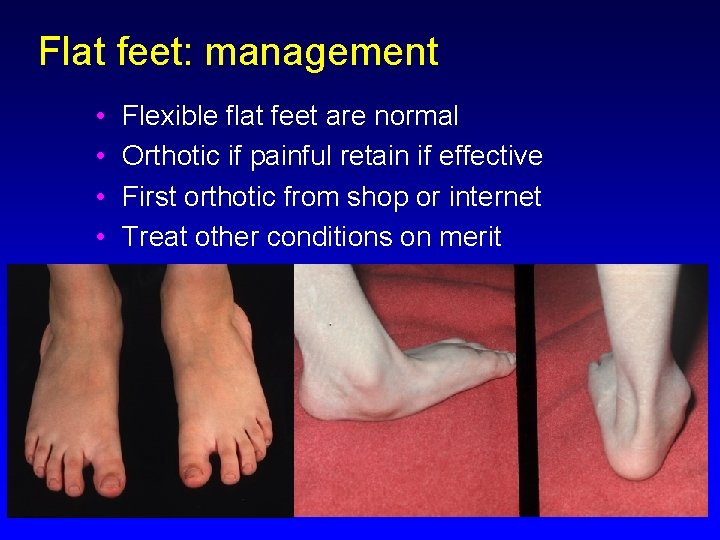 Flat feet: management • • Flexible flat feet are normal Orthotic if painful retain