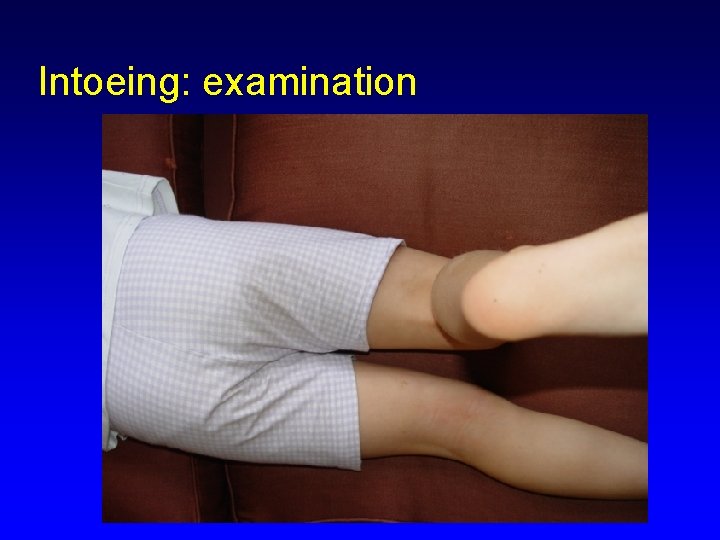 Intoeing: examination 