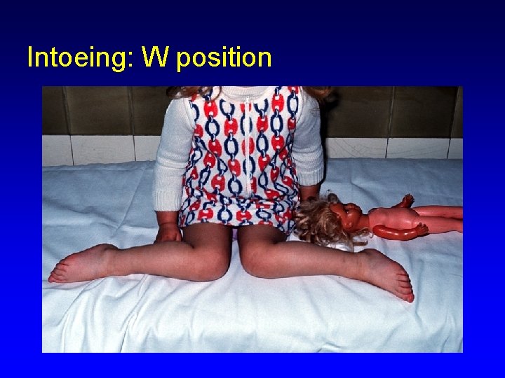 Intoeing: W position 