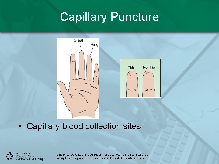 Capillary Puncture • Capillary blood collection sites © 2014 Cengage Learning. All Rights Reserved.