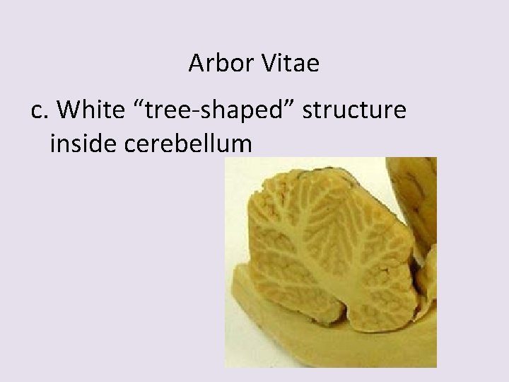 Arbor Vitae c. White “tree-shaped” structure inside cerebellum 