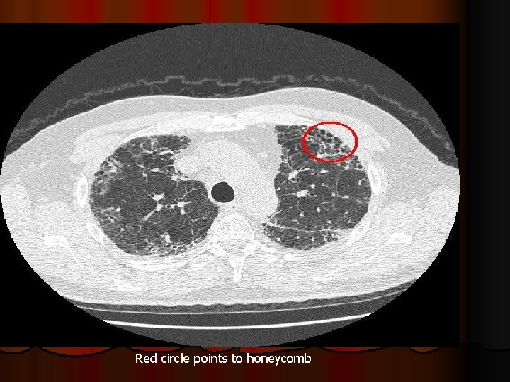 Red circle points to honeycomb 