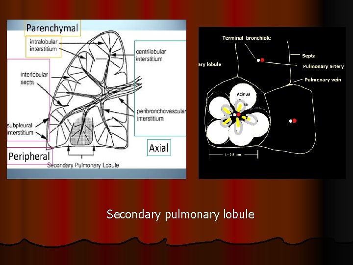 Secondary pulmonary lobule 