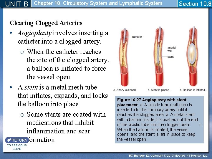 UNIT B Chapter 10: Circulatory System and Lymphatic System Section 10. 8 Clearing Clogged