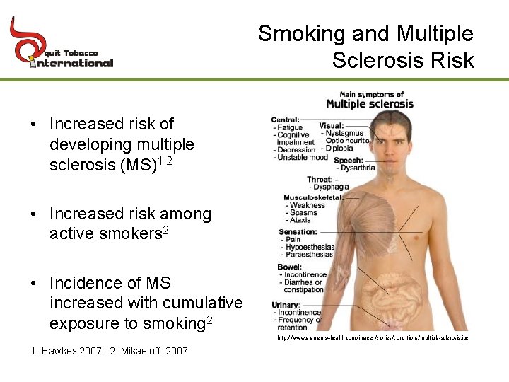 Smoking and Multiple Sclerosis Risk • Increased risk of developing multiple sclerosis (MS)1, 2