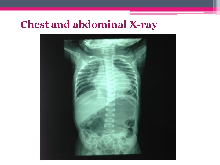 Chest and abdominal X-ray 