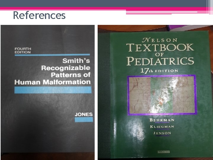 References 