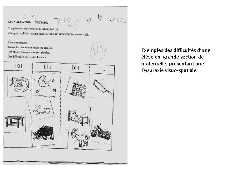 Exemples difficultés d’une élève en grande section de maternelle, présentant une Dyspraxie visuo-spatiale. 