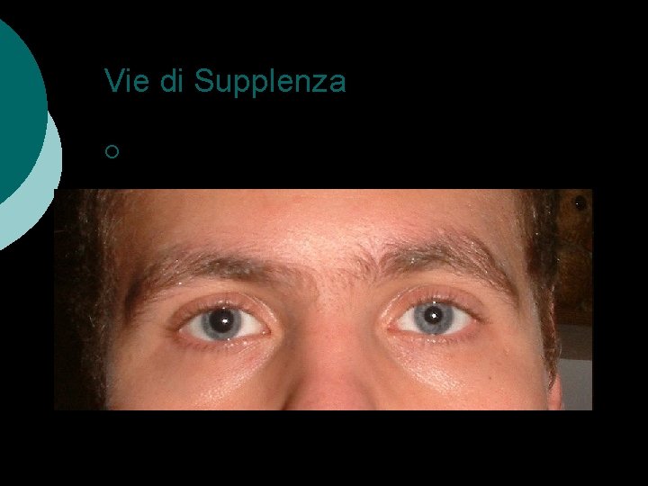 Vie di Supplenza ¡ Poligono di Willis ¡ Anastomosi l l Carotide interna ed