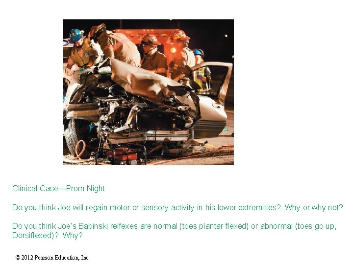 Clinical Case—Prom Night Do you think Joe will regain motor or sensory activity in