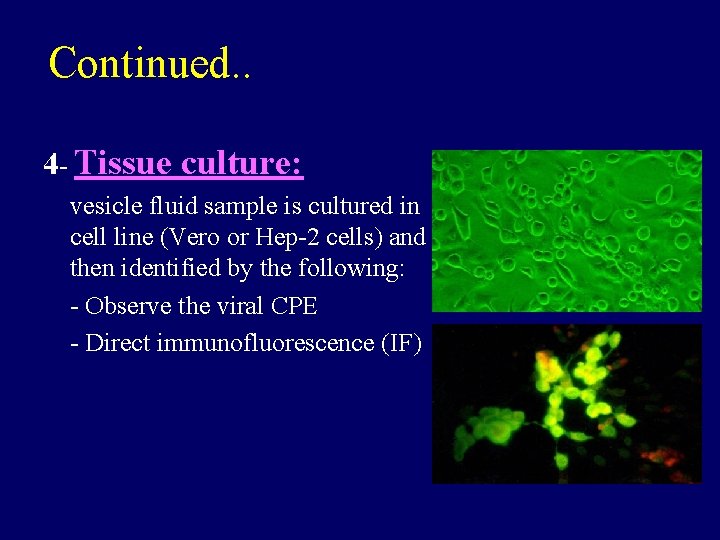 Continued. . 4 - Tissue culture: vesicle fluid sample is cultured in cell line