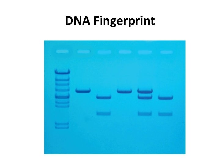 DNA Fingerprint  DNA Fingerprint