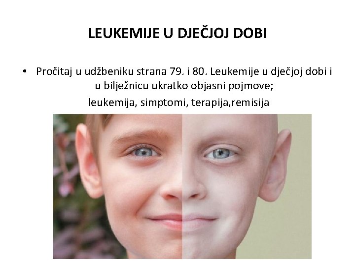 LEUKEMIJE U DJEČJOJ DOBI • Pročitaj u udžbeniku strana 79. i 80. Leukemije u