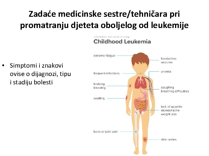 Zadaće medicinske sestre/tehničara pri promatranju djeteta oboljelog od leukemije • Simptomi i znakovi ovise