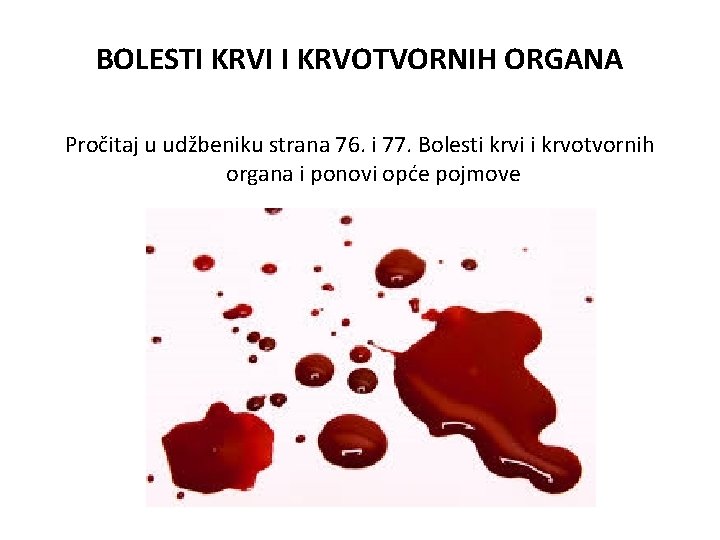 BOLESTI KRVI I KRVOTVORNIH ORGANA Pročitaj u udžbeniku strana 76. i 77. Bolesti krvi