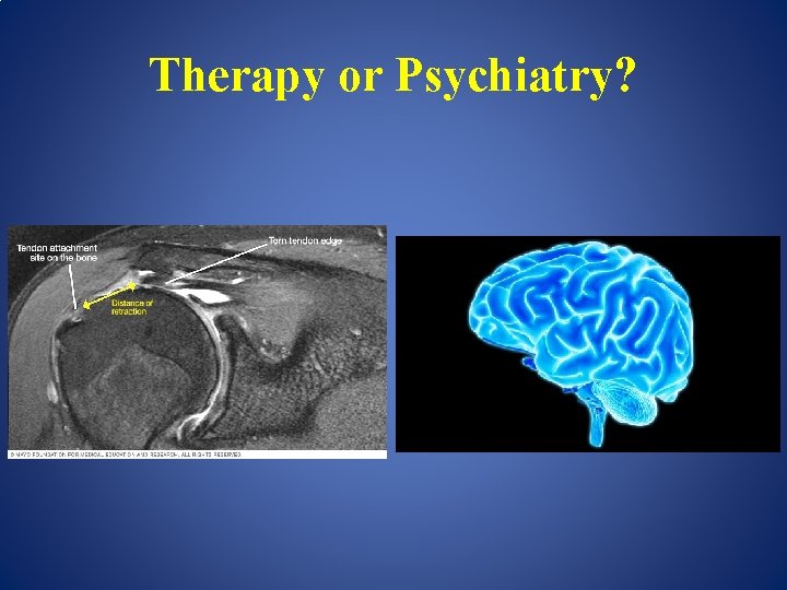 Therapy or Psychiatry? 