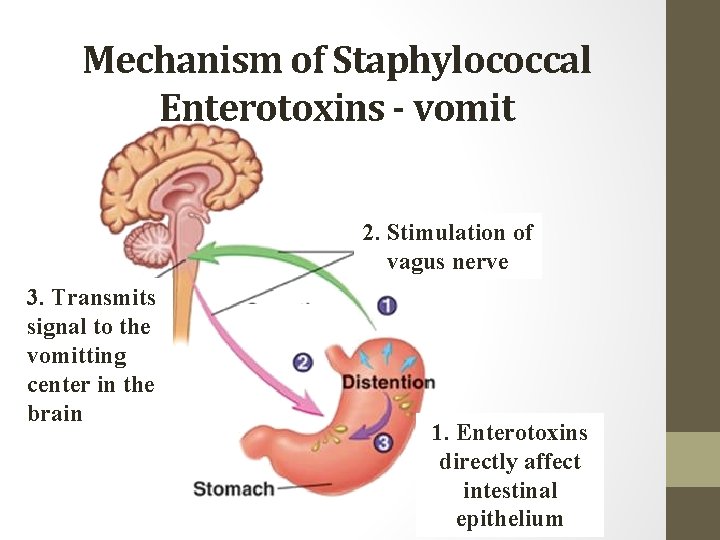 Mechanism of Staphylococcal Enterotoxins - vomit 2. Stimulation of vagus nerve 3. Transmits signal