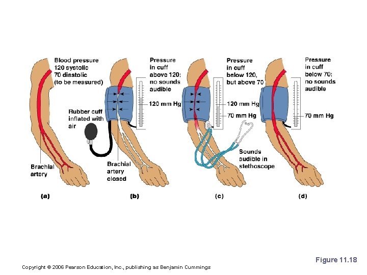 Measuring Arterial Blood Pressure Figure 11. 18 Copyright © 2006 Pearson Education, Inc. ,