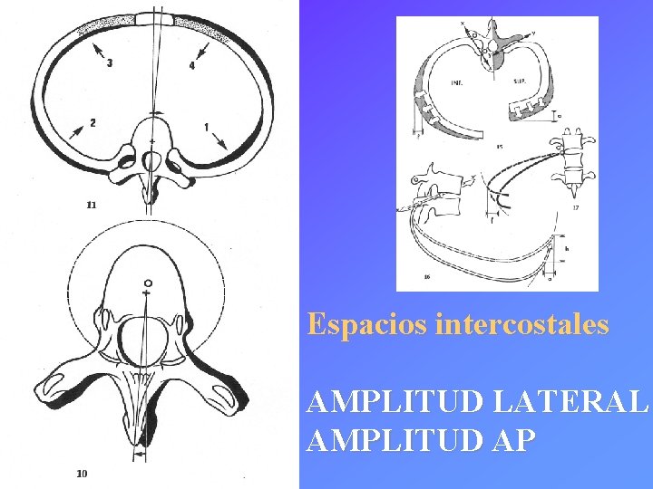 Espacios intercostales AMPLITUD LATERAL AMPLITUD AP 