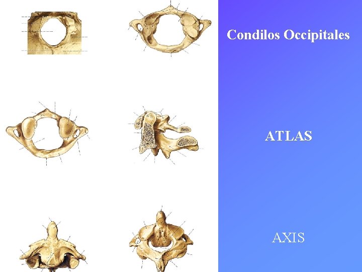 Condilos Occipitales ATLAS AXIS 