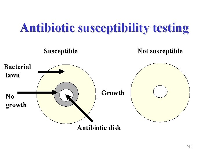 Antibiotic susceptibility testing Susceptible Not susceptible Bacterial lawn No growth Growth Antibiotic disk 20