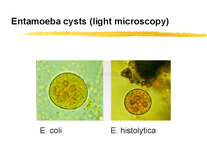 Entamoeba cysts (light microscopy) E. coli E. histolytica 