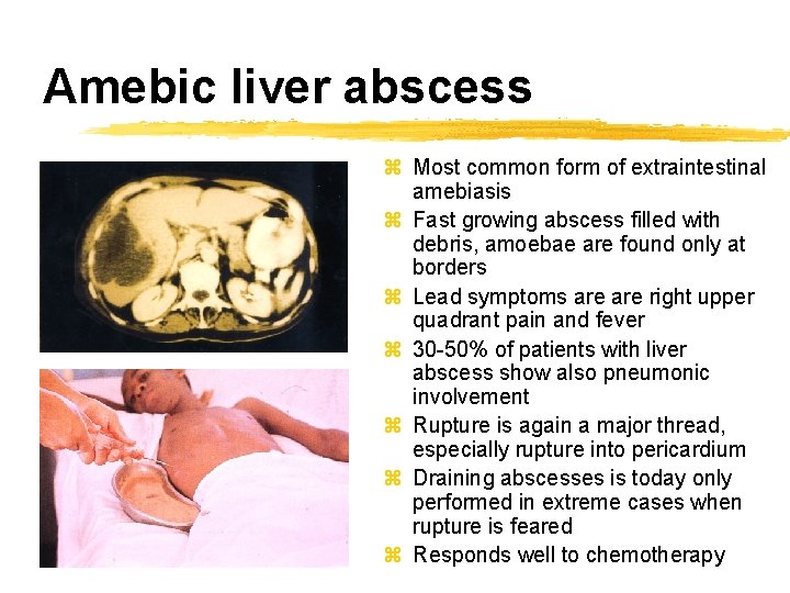 Amebic liver abscess z Most common form of extraintestinal amebiasis z Fast growing abscess