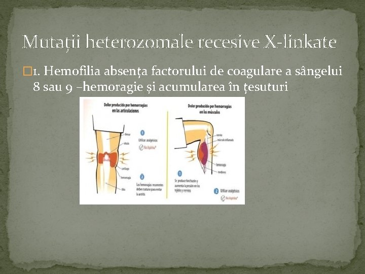 Mutații heterozomale recesive X-linkate � 1. Hemofilia absența factorului de coagulare a sângelui 8