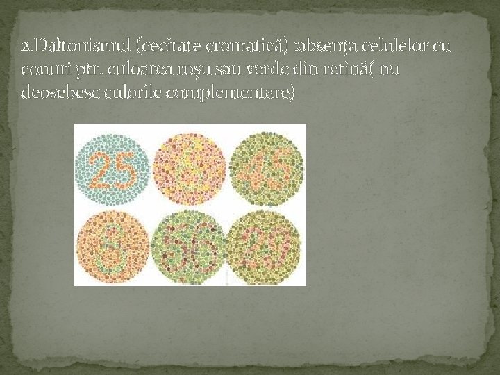 2. Daltonismul (cecitate cromatică) : absența celulelor cu conuri ptr. culoarea roșu sau verde