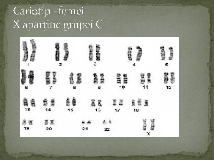 Cariotip –femei X aparține grupei C 