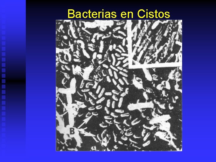 Bacterias en Cistos 