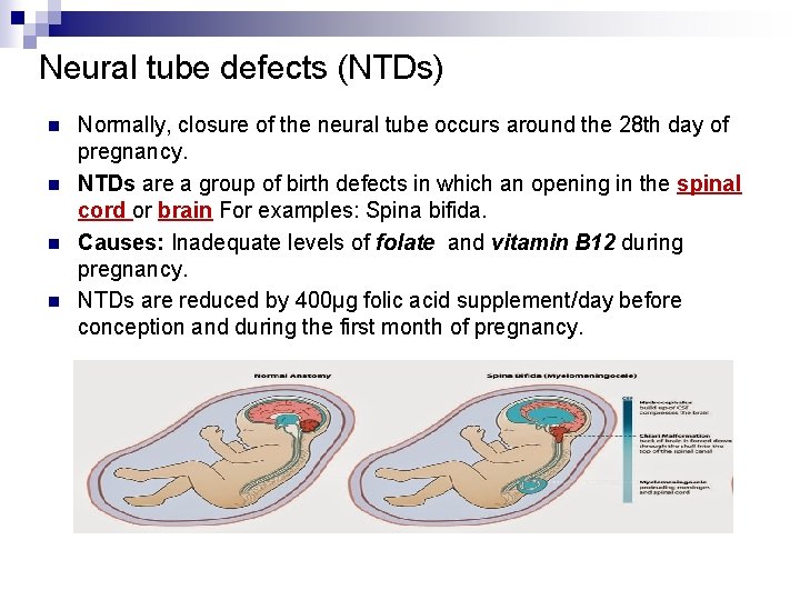 Neural tube defects (NTDs) n n Normally, closure of the neural tube occurs around