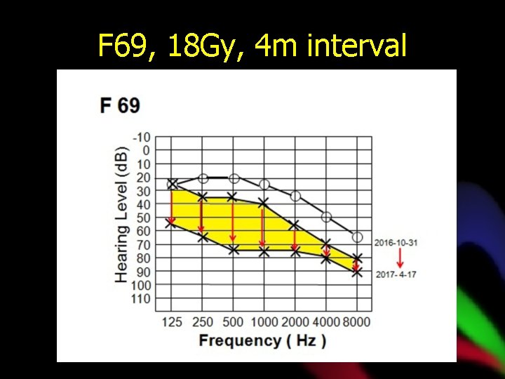 F 69, 18 Gy, 4 m interval 
